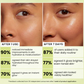 Hyphen Golden Hour Glow Face Moisturizer with Triple Vitamin C & 3% Niacinamide | Swadesiicart