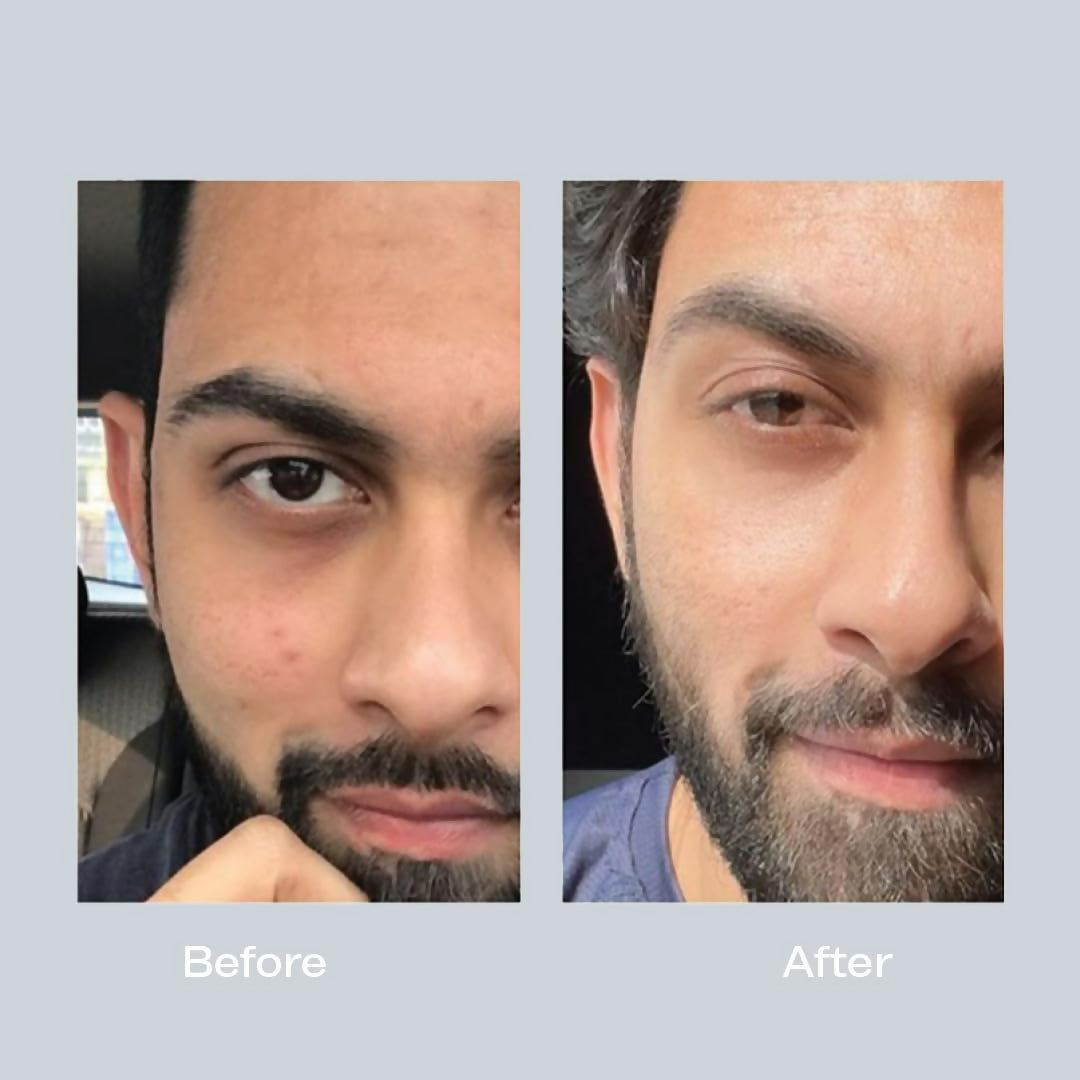 3 AM Vitamin C Serum For Uneven Skin - Swadesiicart