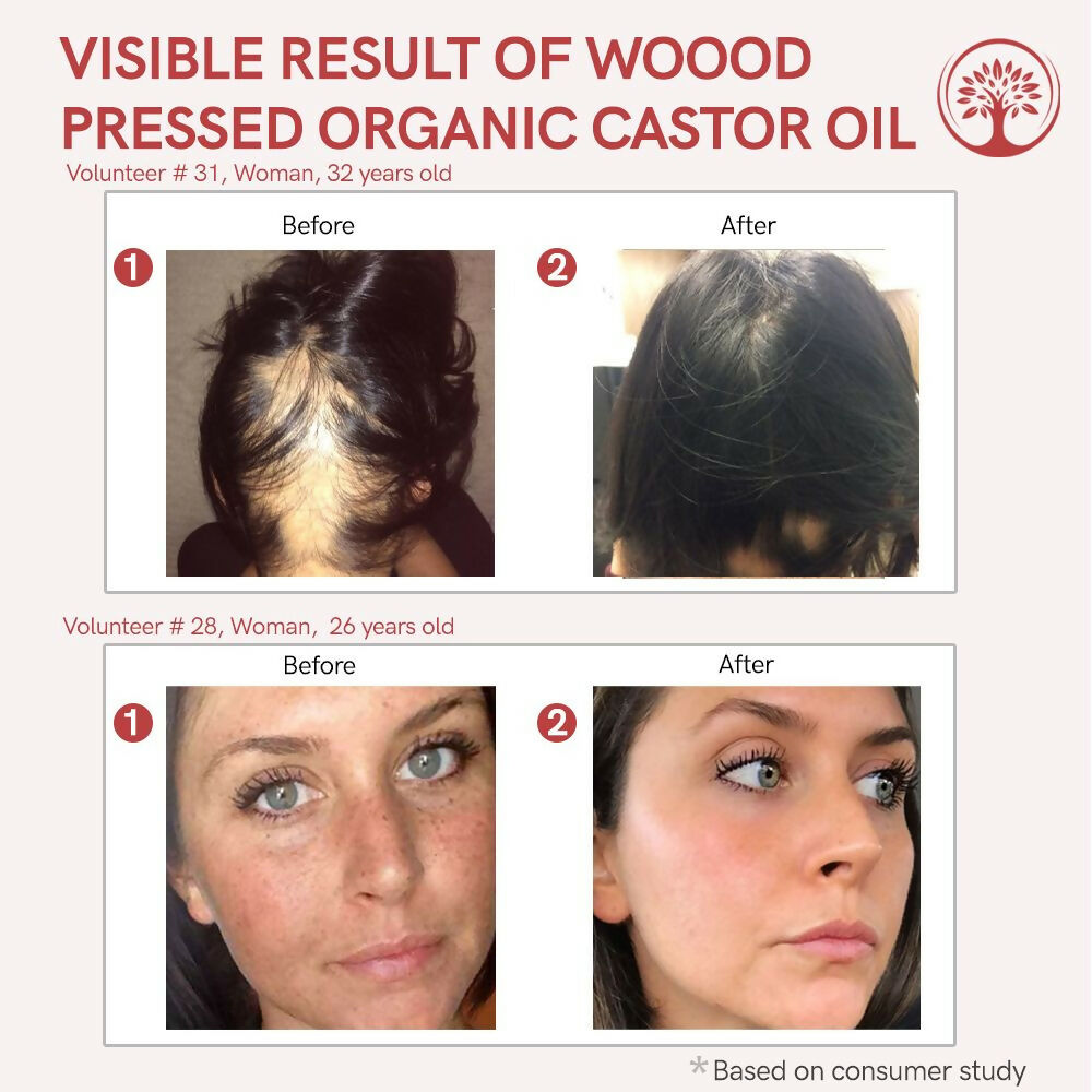 Ivory Natural Wood Pressed Organic Castor Oil For Healthy Skin & Hair Wellness | Swadesiicart