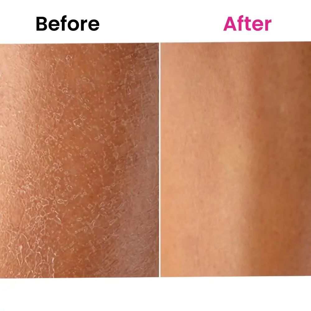 ThriveCo Skin Expert Oil | Swadesiicart