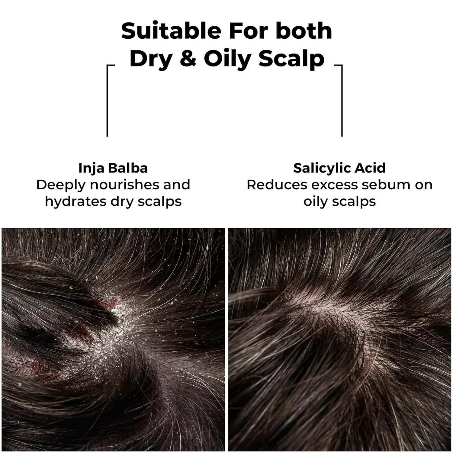 Brillare Dandruff Control Shampoo