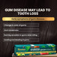 Himalaya Ayurveda Gum Care Toothpaste - Swadesiicart
