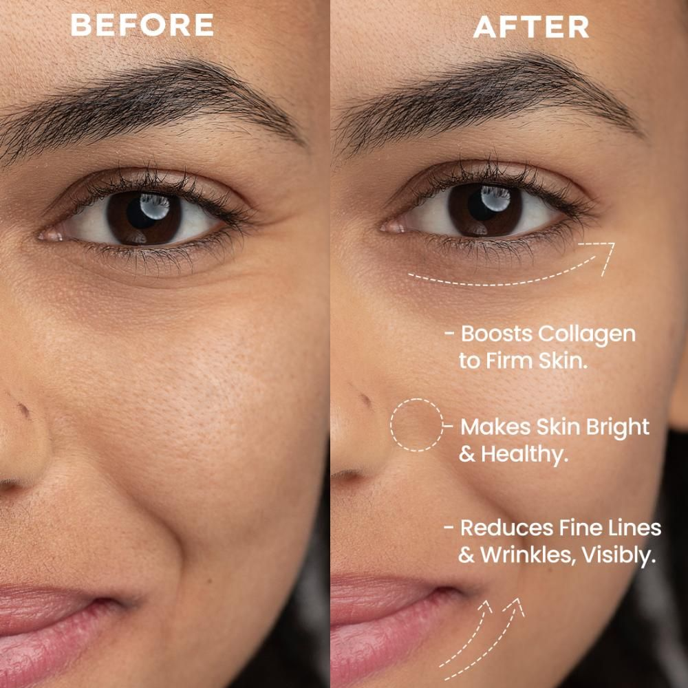 Hyphen By Kriti Sanon 0.05% Retinal Reset Serum, Boosts Collagen, Reduces Wrinkles | Swadesiicart