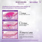 Mederma Advanced Plus Scar Gel - Swadesiicart