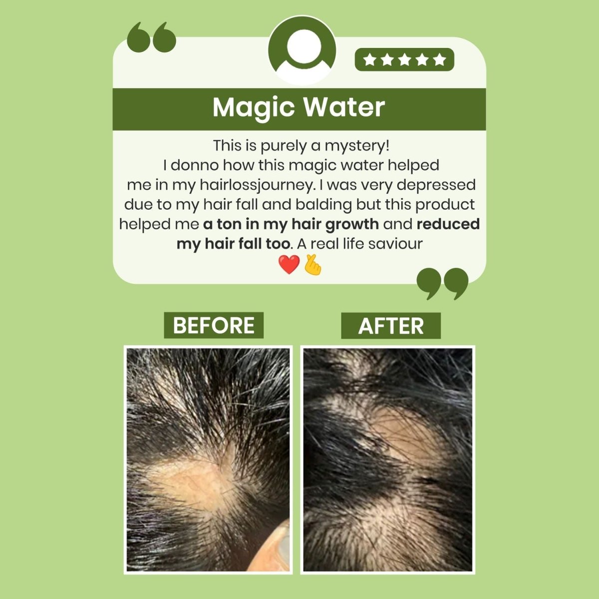 Alps Goodness Rosemary Water for Hair Regrowth - Swadesiicart