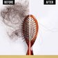 Pantene Advanced Hair Fall Solution | Swadesiicart