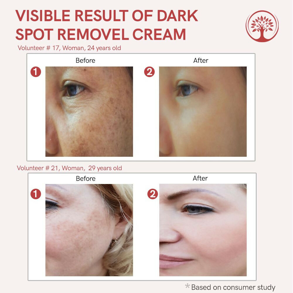 Ivory Natural Dark Spot Removal Face Cream For Dark Spots And Achieve A Glowing Tone | Swadesiicart