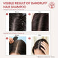 Ivory Natural Dandruff Shampoo - Embrace A Rejuvenated Scalp | Swadesiicart