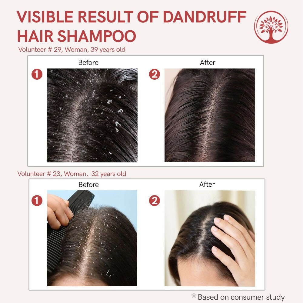 Ivory Natural Dandruff Shampoo - Embrace A Rejuvenated Scalp | Swadesiicart