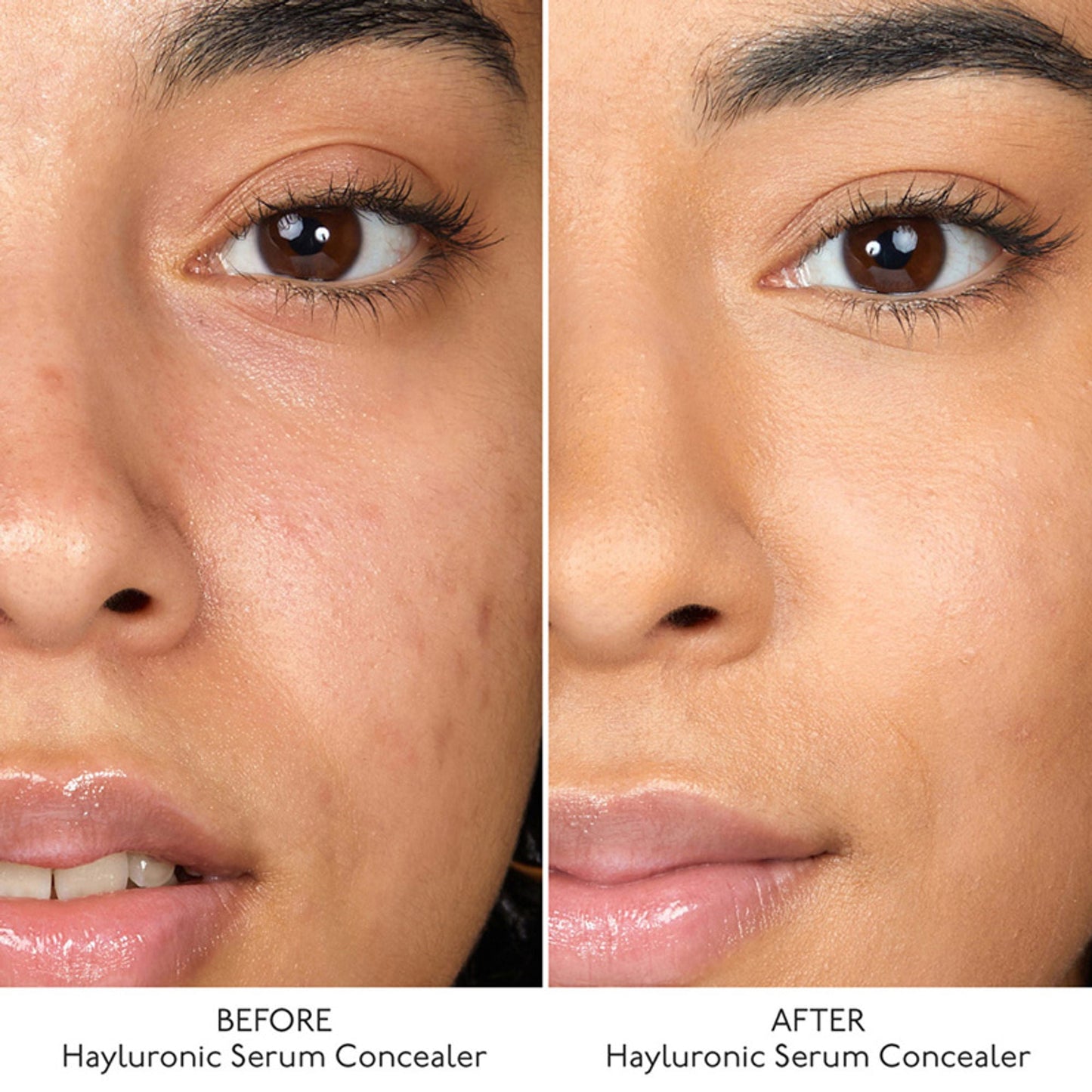 By Terry Hyaluronic Serum Concealer - 5. Cream Beige