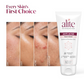 Alite Anti-Acne 5-in-1 Face Wash - Encapsulated Charcoal, Sebum Control Enzyme & Ceramides