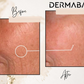 Dermabay Retinol 0.2% Face Serum | Swadesiicart