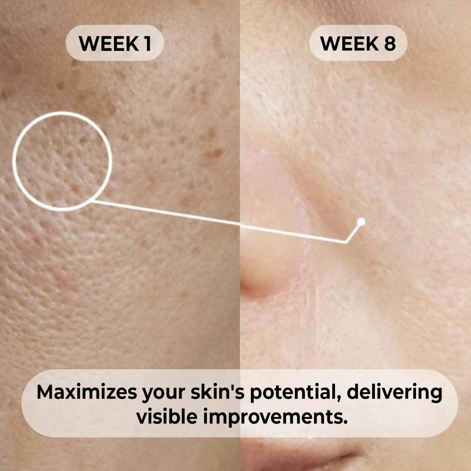 Dermabay Niacinamide 5%+ Hyaluronic acid 1% Serum | Swadesiicart