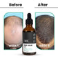 ThriveCo Hair Growth Serum 2.0 | Swadesiicart