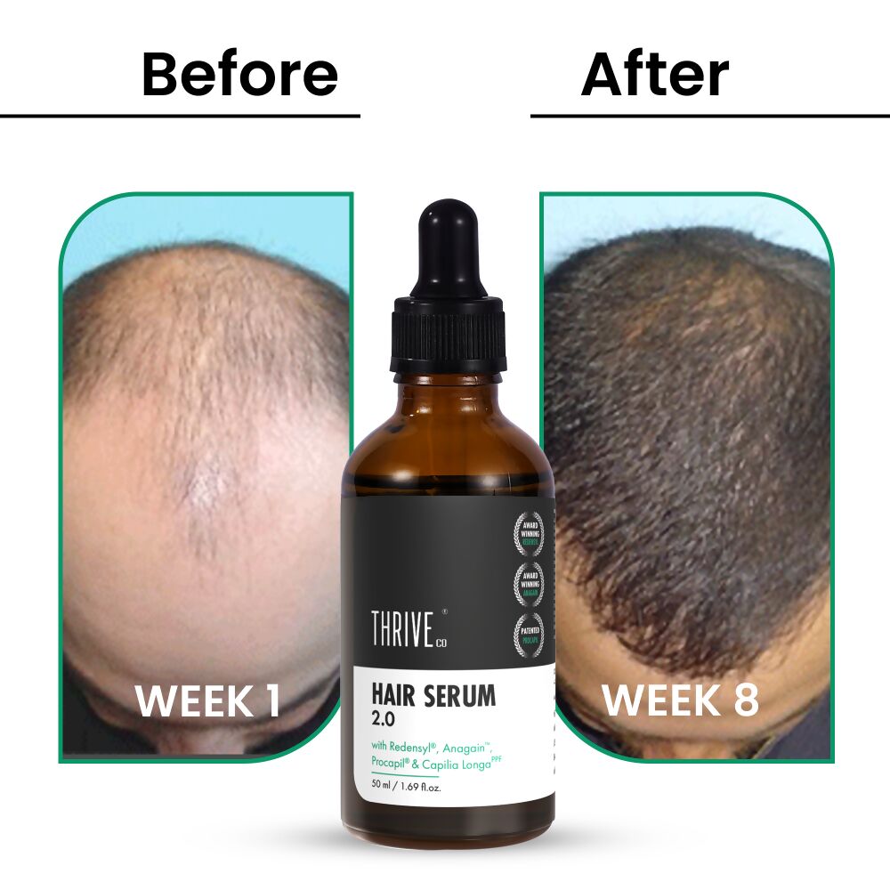 ThriveCo Hair Growth Serum 2.0 | Swadesiicart