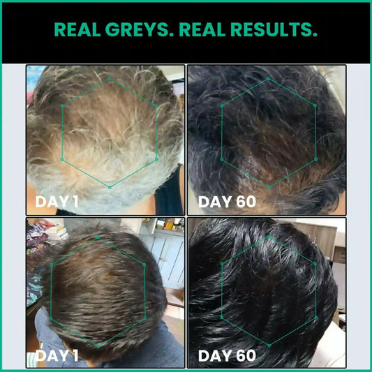 ThriveCo Anti-Greying Hair Prime Serum | Swadesiicart