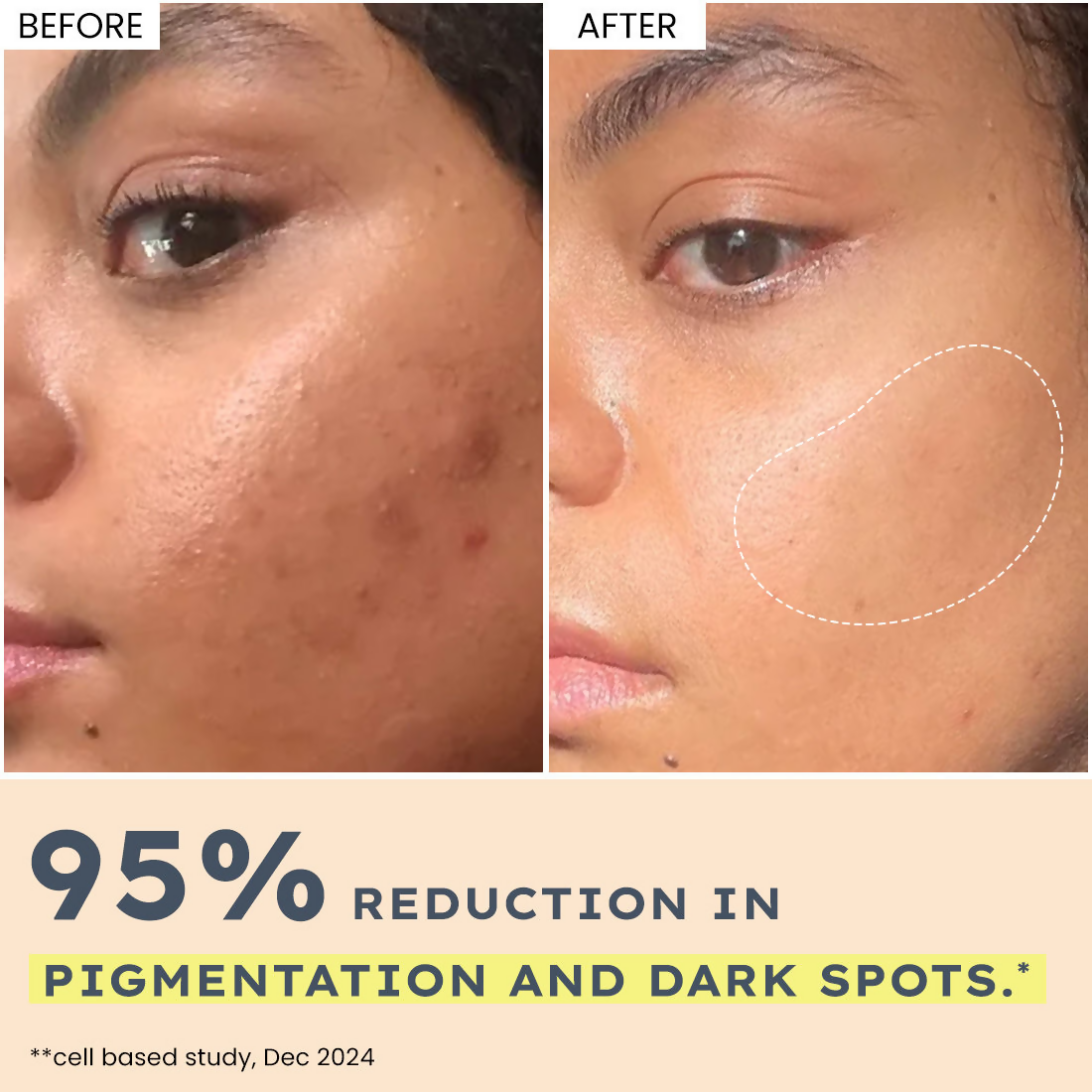 Hyphen By Kriti Sanon 44% Rice Water Brightening Serum Pads (50pcs) | Swadesiicart
