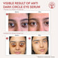 Ivory Natural Dark Circle Eye Serum For Dark Eye Circles, Under-Eye Patches, Swollen Eyes | Swadesiicart