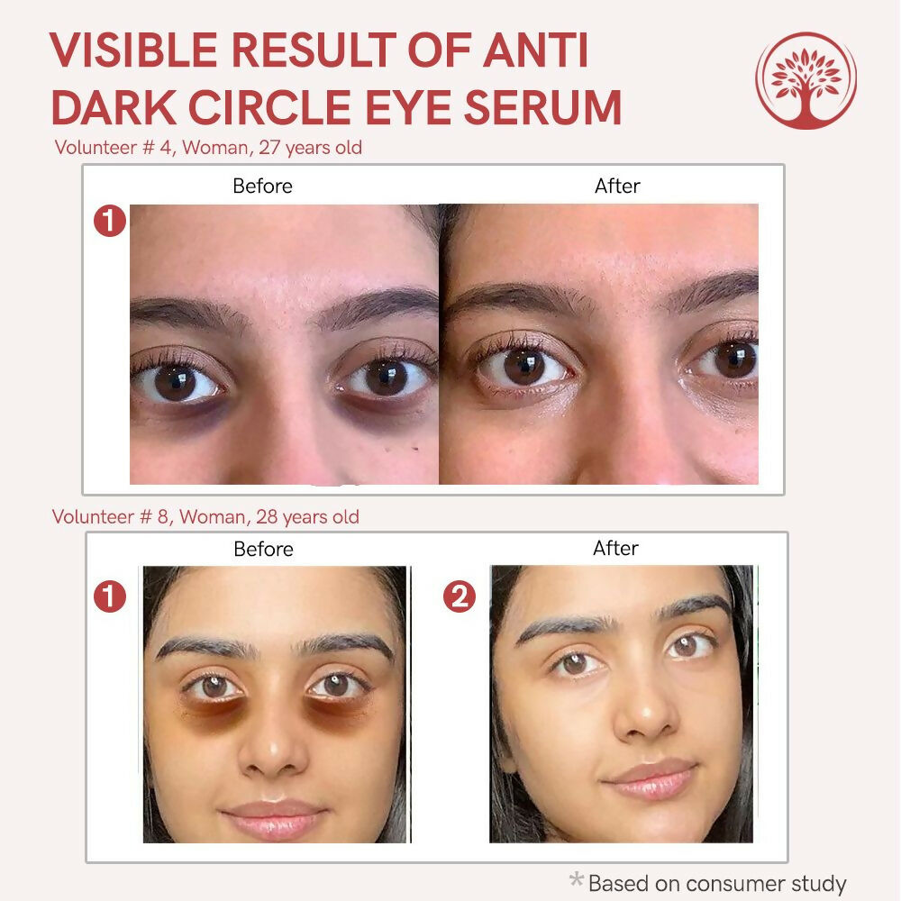 Ivory Natural Dark Circle Eye Serum For Dark Eye Circles, Under-Eye Patches, Swollen Eyes | Swadesiicart