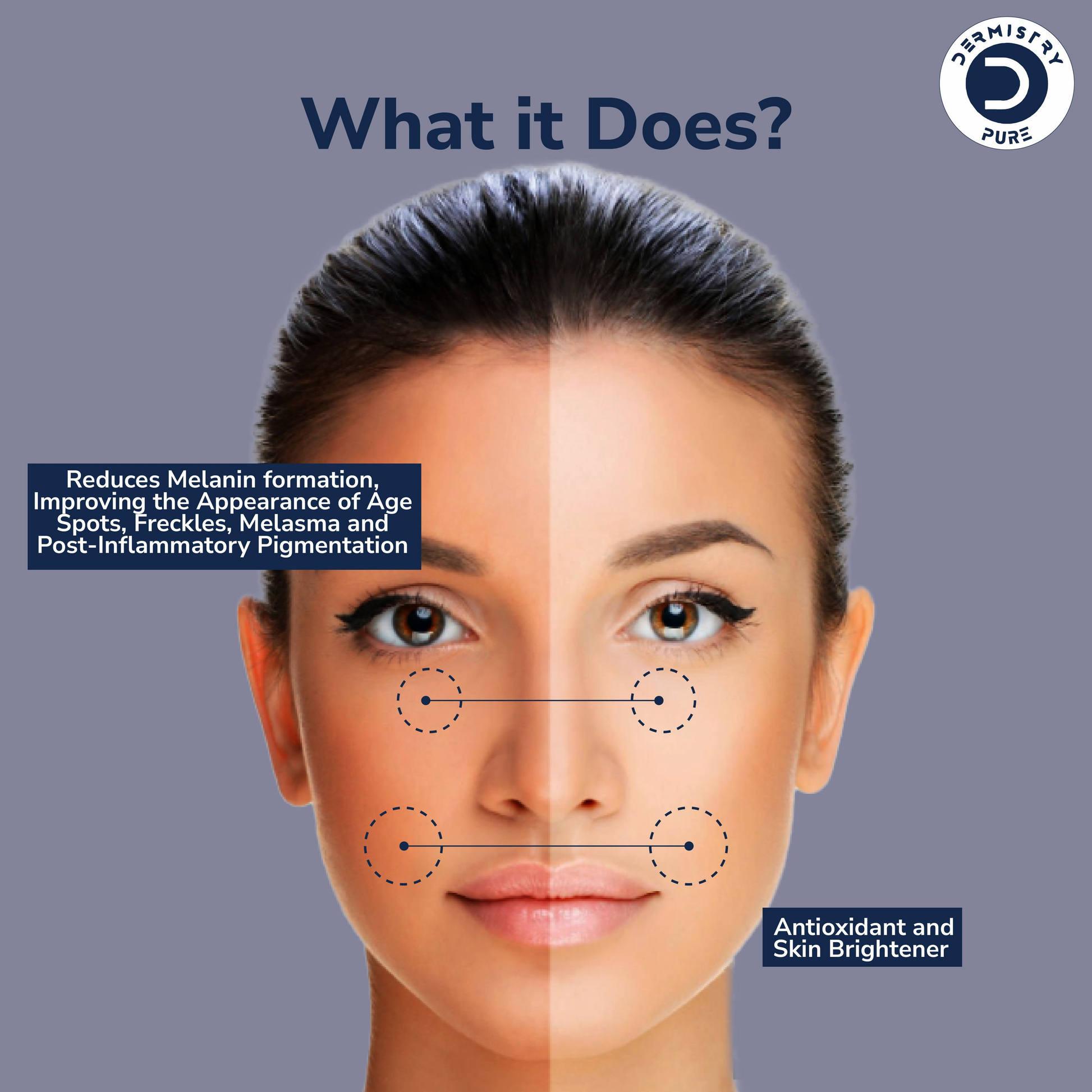 Dermistry 2% Kojic Acid 1% Alpha Arbutin Pigmentation Spots Removal Skin Brightening Face Serum - Swadesiicart
