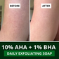 Bake 10% AHA + 1% BHA Scrub Treatment Soap | Swadesiicart