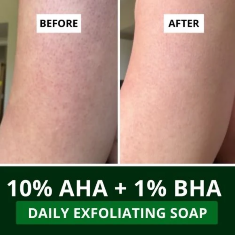 Bake 10% AHA + 1% BHA Scrub Treatment Soap | Swadesiicart