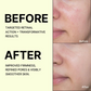 Celimax The Vita-A Retinal Shot Tightening Booster For Anti-Aging, Dark Spots & Wrinkles