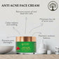 Ivory Natural Acne Face Cream For Acne Free Face | Swadesiicart