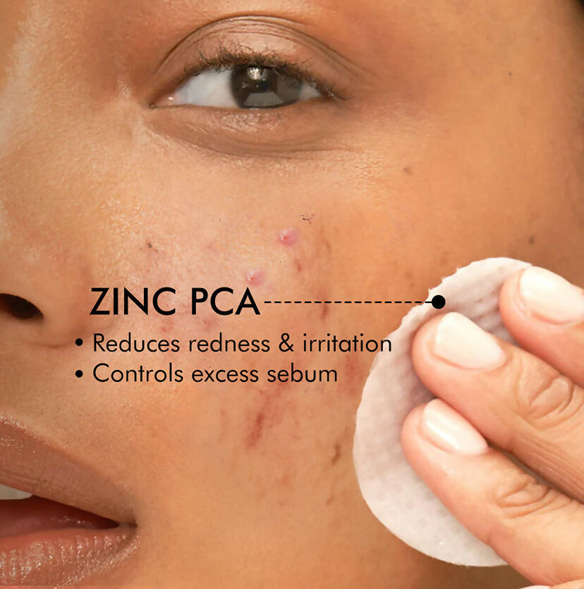 mCaffeine 2% Salicylic Acid Serum Clear Skin Acne Pads - Acne & Oil Control with Matcha Tea - Swadesiicart