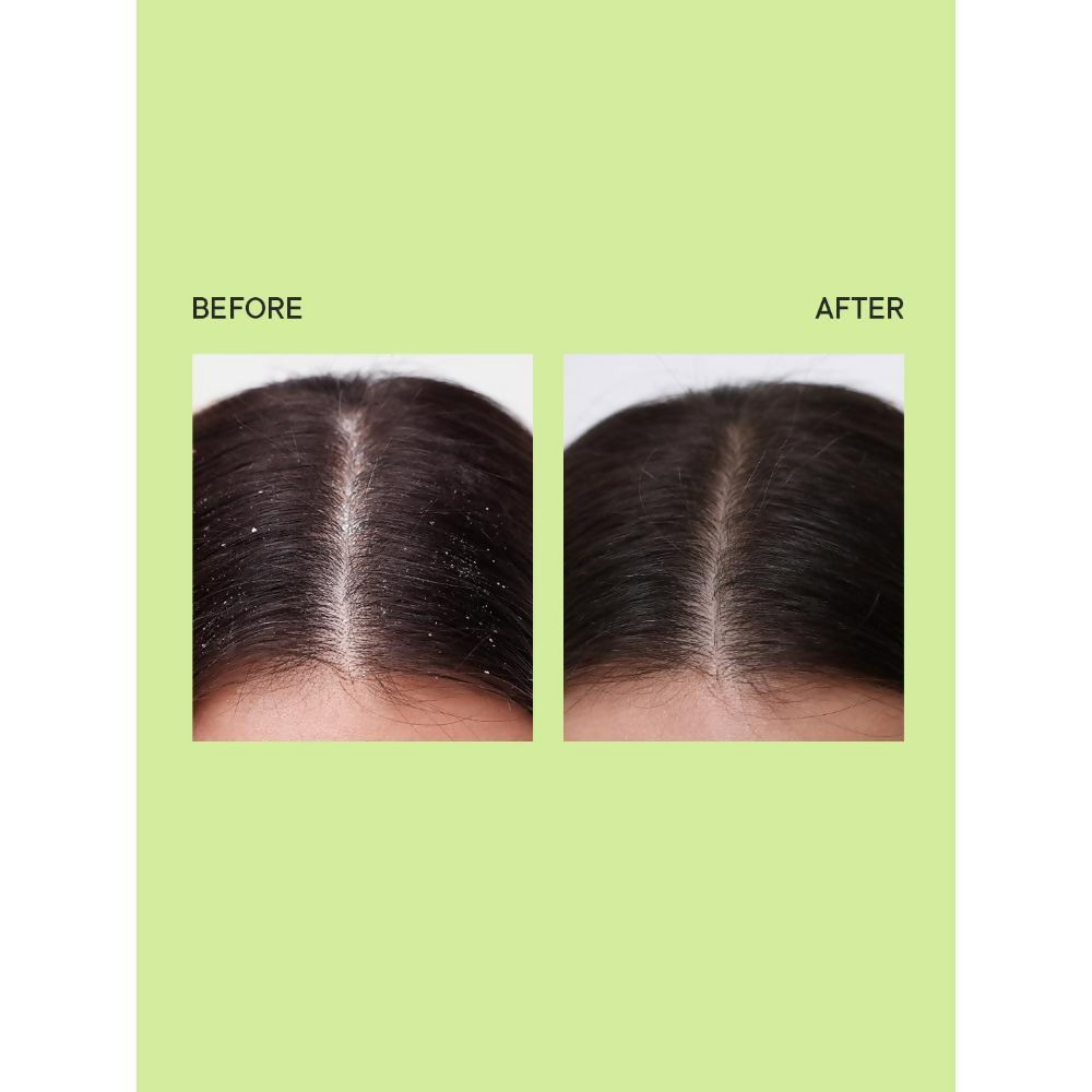 Quench Anti Dandruff Shampoo | Swadesiicart