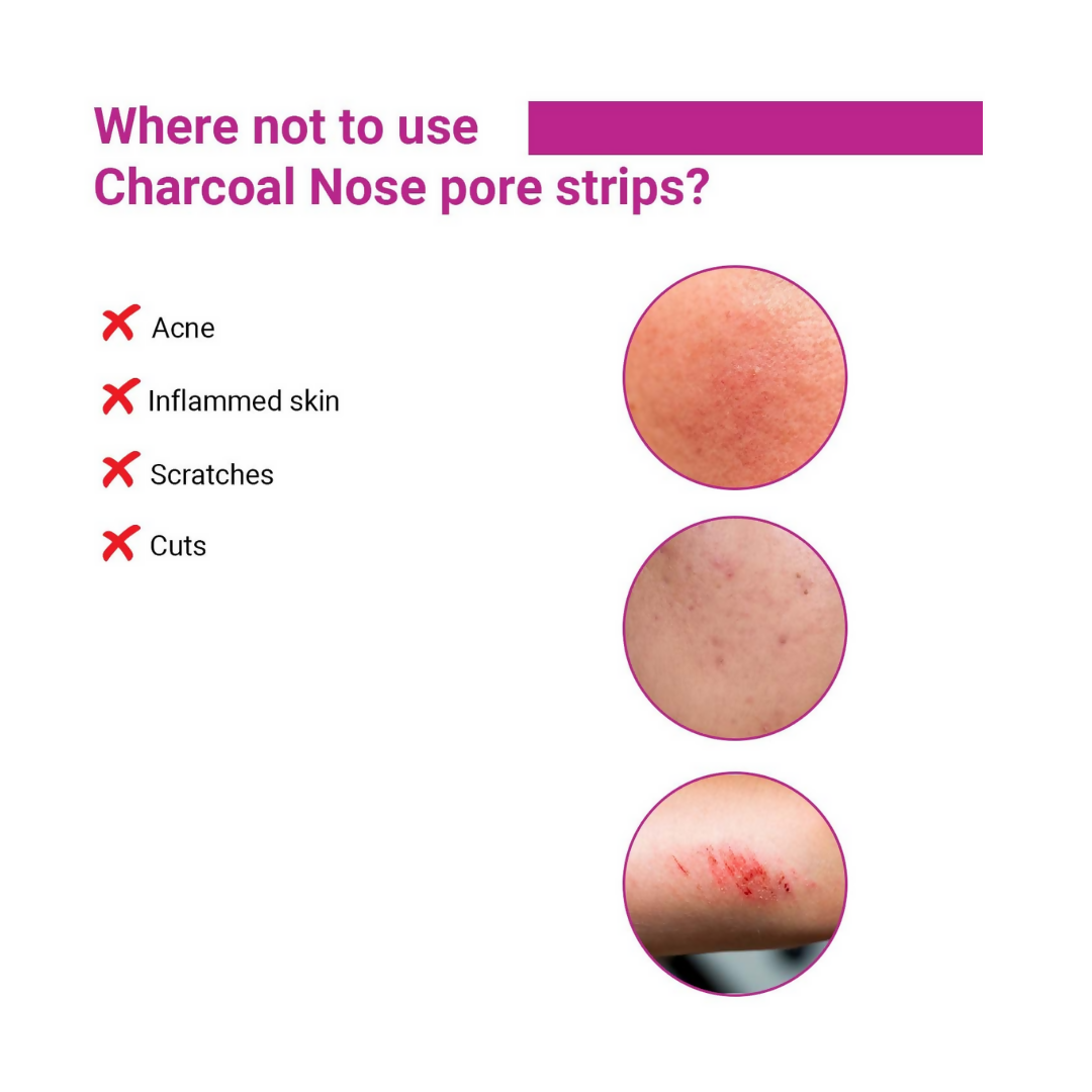 Sotrue Charcoal Nose Pore Deep Cleansing Strips - Swadesiicart