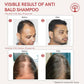 Ivory Natural Bald Shampoo Organic For Loss Of Hair And Get Fuller Thicker Hair | Swadesiicart
