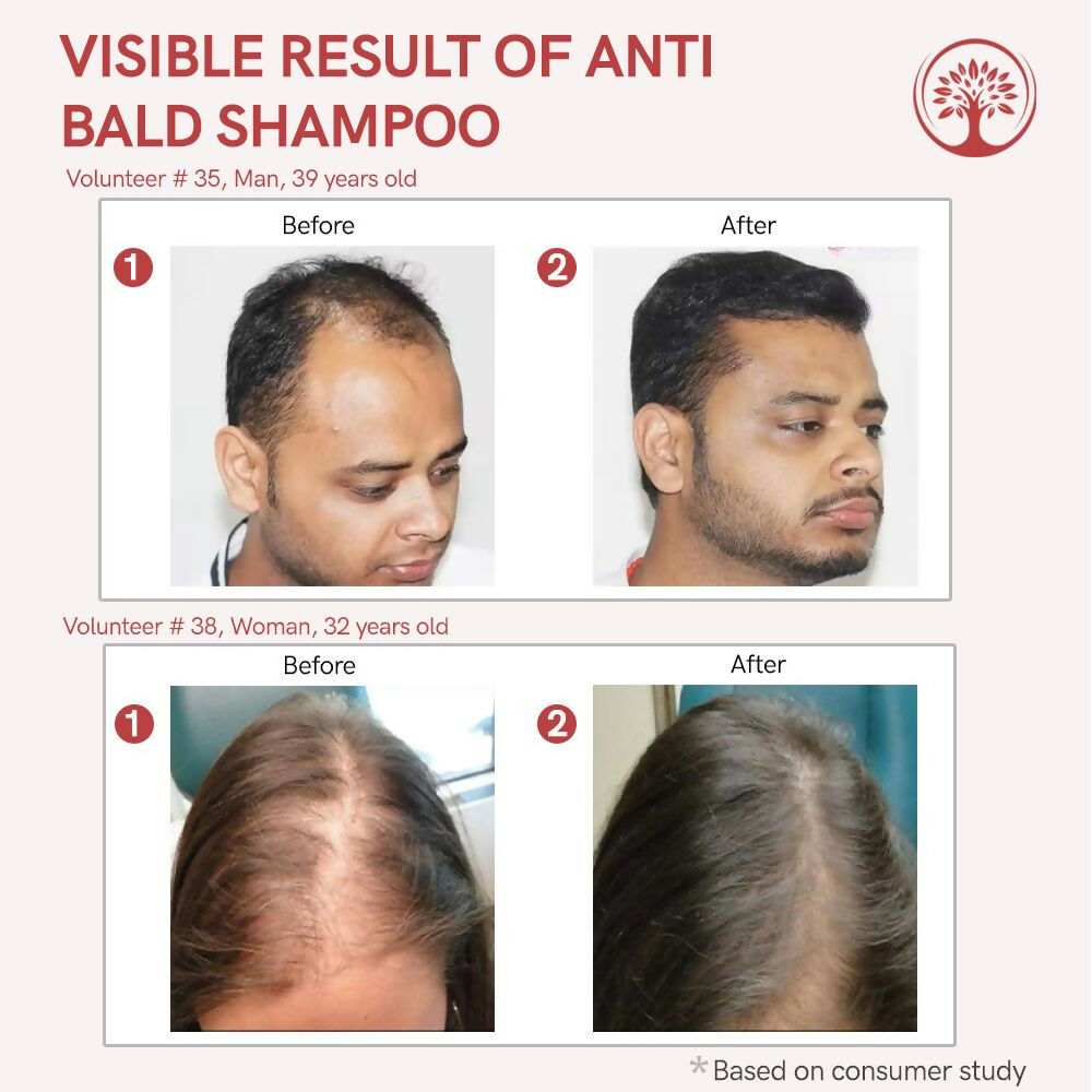 Ivory Natural Bald Shampoo Organic For Loss Of Hair And Get Fuller Thicker Hair | Swadesiicart