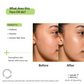 Nature Derma Multi-Purpose Dry Oil | Swadesiicart