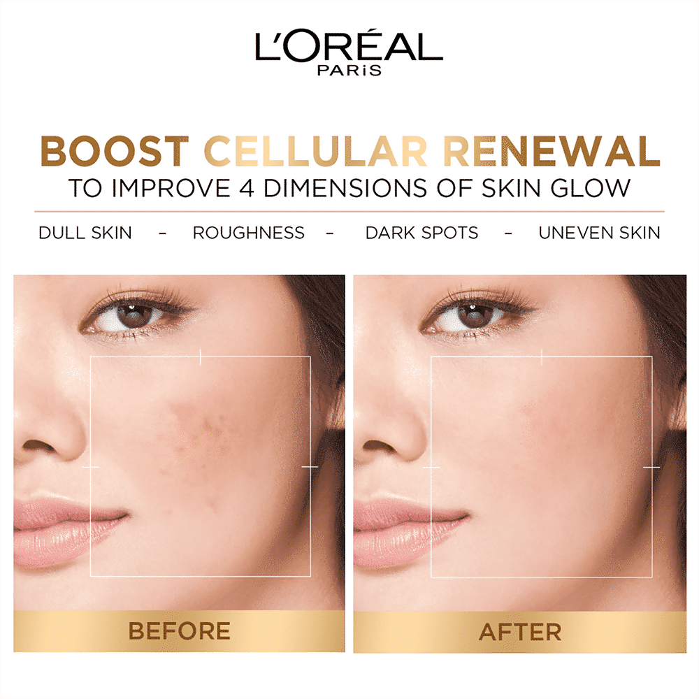 L'Oreal Paris Glycolic Acid Glowing And Protecting CSMS (Cleanser, Serum, Moisturizer, Sunscreen) Regime Kit | Swadesiicart