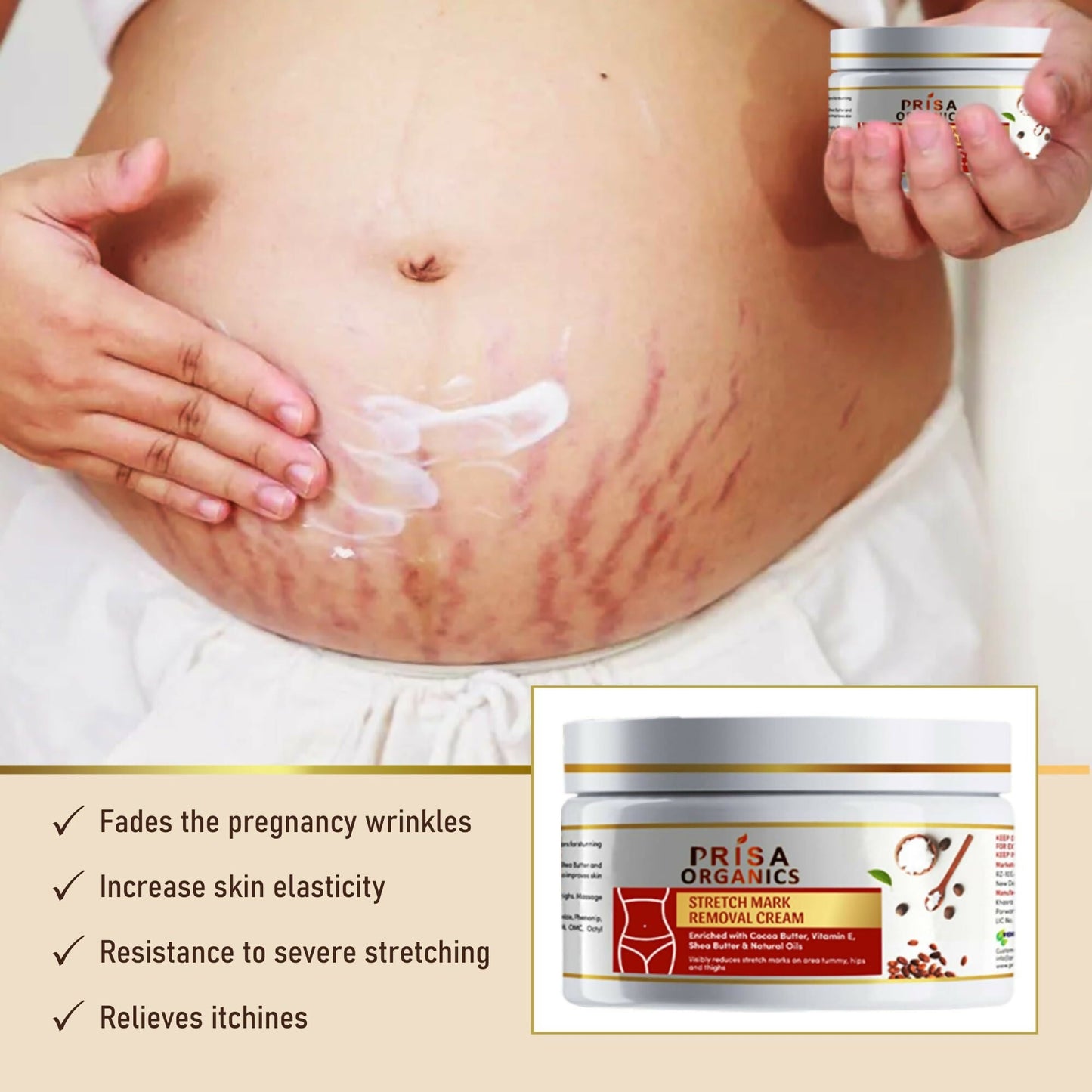 Prisa Organics Stretch Mark Removal Cream To Reduce Stretch Marks, Scars, Spots, Discolouration - Swadesiicart