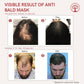 Ivory Natural Bald Mask For Hair - Hair Mask For Less Hair And Hair Thinning | Swadesiicart