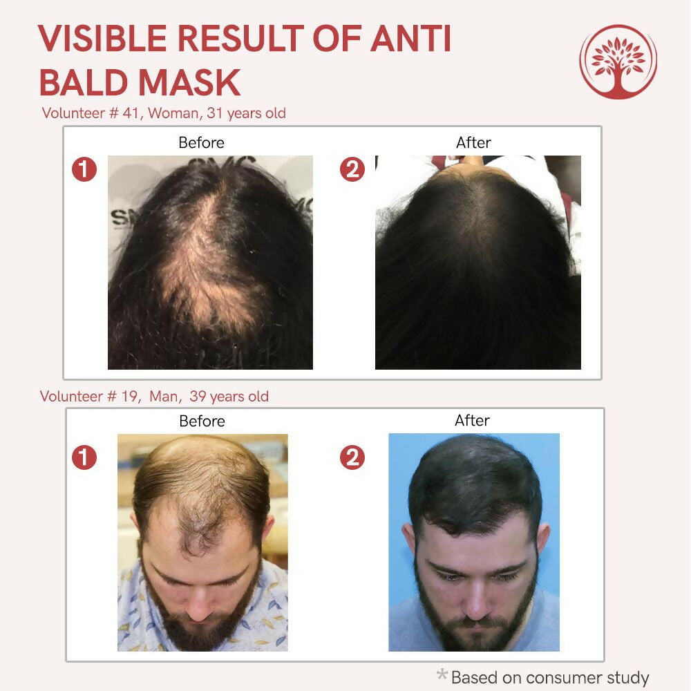 Ivory Natural Bald Mask For Hair - Hair Mask For Less Hair And Hair Thinning | Swadesiicart