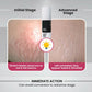 ThriveCo Stretch Marks Expert Serum Cream - Swadesiicart