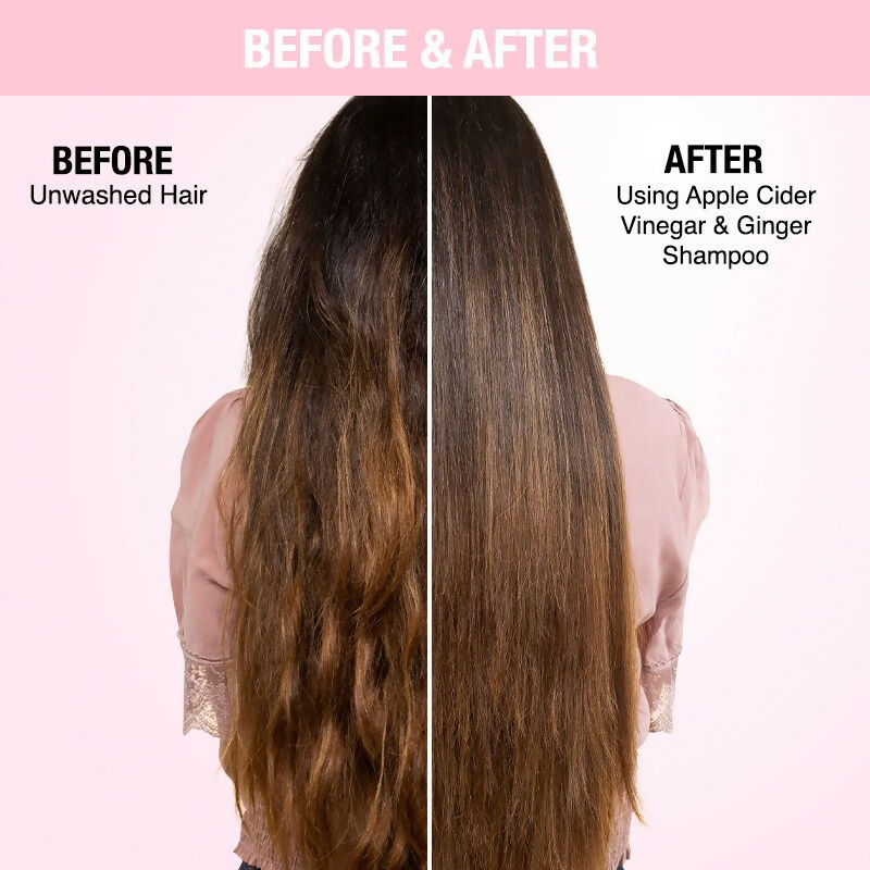 Nykaa Naturals Anti-Dandruff - Free Shampoo with Apple Cider Vinegar, Ginger & Tea Tree Oil - Swadesiicart
