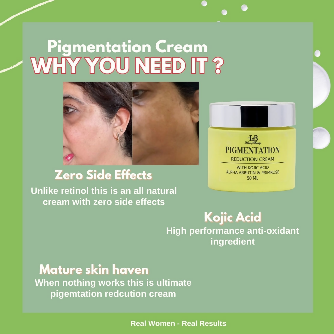 House of Beauty Pigmentation Reduction Cream - Swadesiicart
