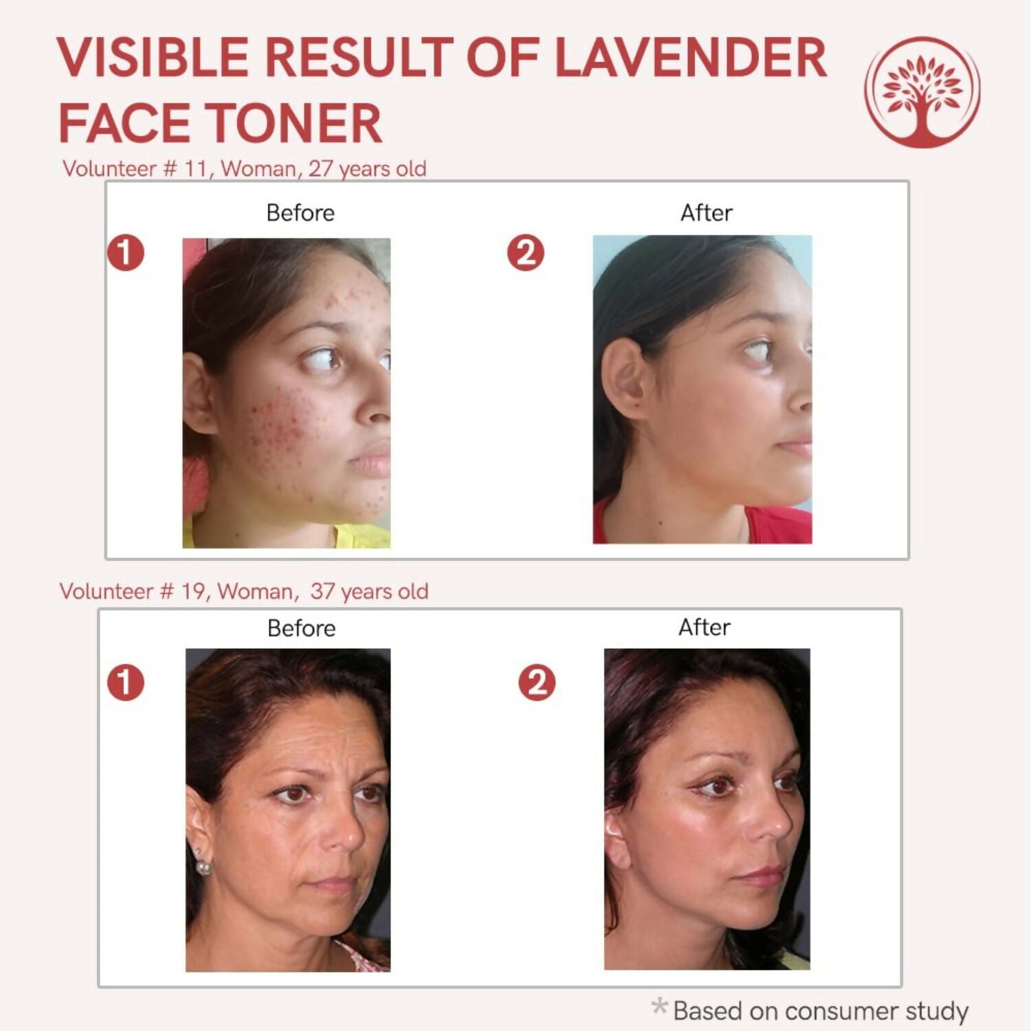 Ivory Natural Lavender Facial Toner For Acne, Even Skin Tone | Swadesiicart