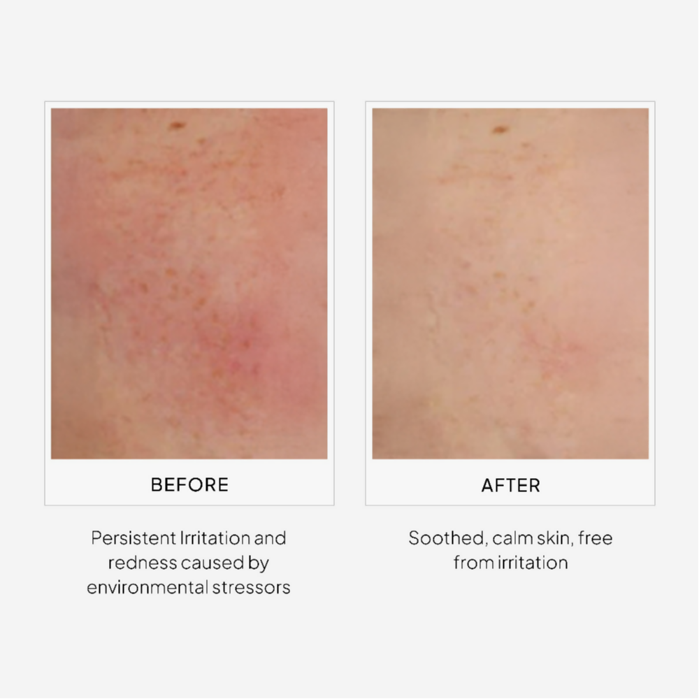 Miduty by Palak Notes EpiShield Day Serum | Swadesiicart