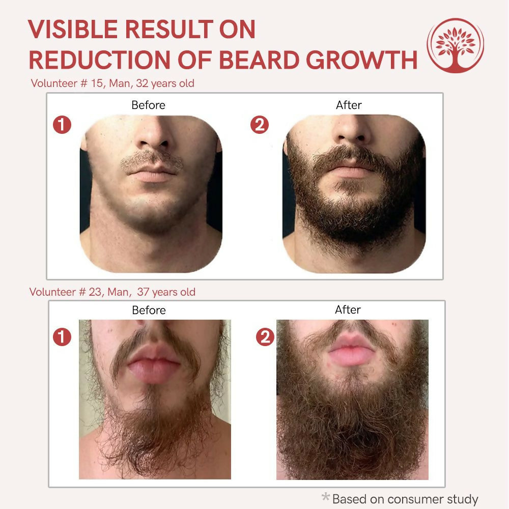 Ivory Natural Beard Growth Serum For Beard Wellness | Swadesiicart