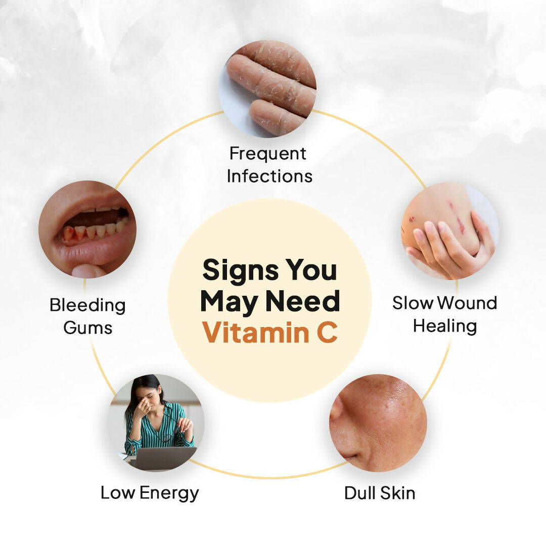 Miduty by Palak Notes Liposomal Vitamin C - Immunity Booster Capsules - Swadesiicart