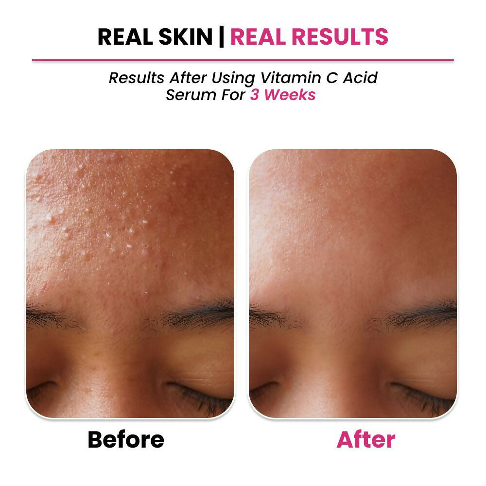 Thriveco 10% Vitamin C+ Hyaluronic Acid Serum | Swadesiicart