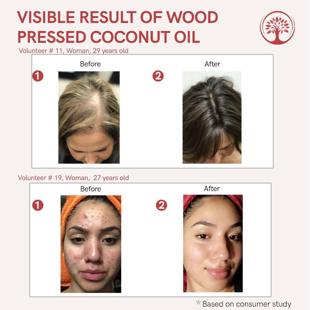 Ivory Natural Wood Pressed Organic Coconut Oil , Premium Extra Virgin Oil - For Radiant Skin, Hair Wellness & Baby Care | Swadesiicart