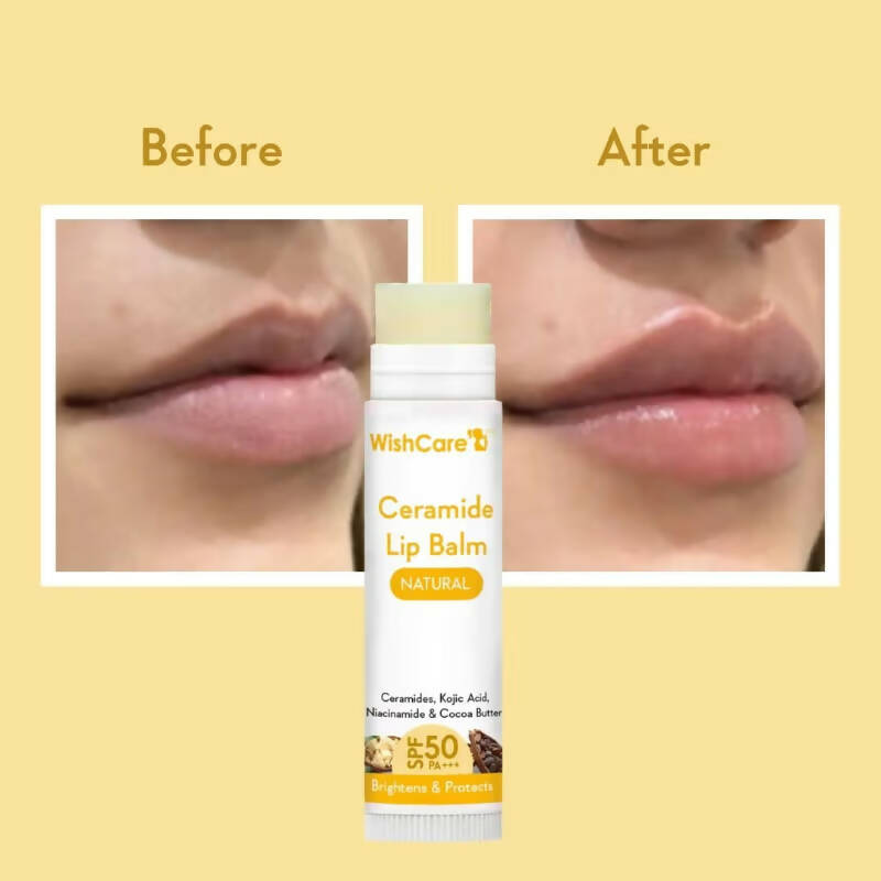 Wishcare Ceramide Lip Balm with SPF50 PA+++ - Natural - Swadesiicart