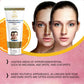 7 Days Natural Pigmentation Removal Cream - Swadesiicart