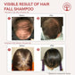 Ivory Natural Falling Hair Shampoo For Scalp And Hair Strength | Swadesiicart
